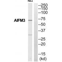 Rabbit Polyclonal Antibody to Collagen XI alpha