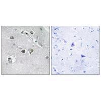 Rabbit Polyclonal Antibody to Collagen XI α2