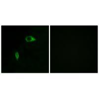 Rabbit Polyclonal Antibody to Collagen XIV α1