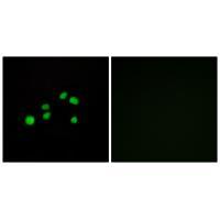 Rabbit Polyclonal Antibody to Collagen XXIII α1