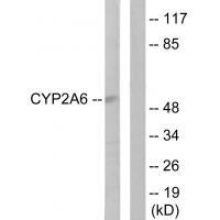 Rabbit Polyclonal Antibody to Cytochrome P452A6