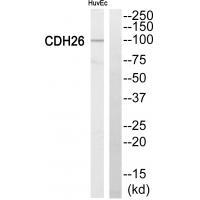Rabbit Polyclonal Antibody to Cytochrome P452C8
