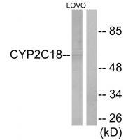 Rabbit Polyclonal Antibody to Cytochrome P452C8/9/18/19
