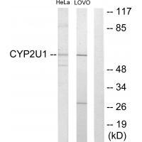 Rabbit Polyclonal Antibody to Cytochrome P452U1