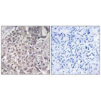 Rabbit Polyclonal Antibody to Cytochrome P454F2