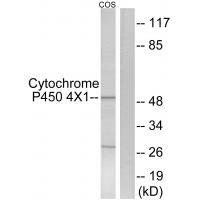 Rabbit Polyclonal Antibody to Cytochrome P454X1