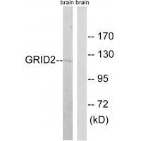 Rabbit Polyclonal Antibody to GRID2