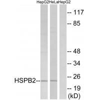 Rabbit Polyclonal Antibody to HSPB2