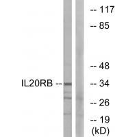 Rabbit Polyclonal Antibody to IL20RB