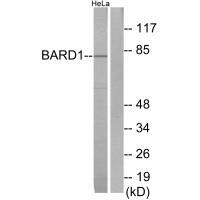Rabbit Polyclonal Antibody to BARD1