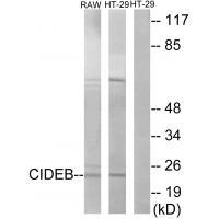 Rabbit Polyclonal Antibody to CIDEB