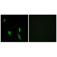 Rabbit Polyclonal Antibody to DCC