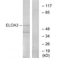 Rabbit Polyclonal Antibody to ELOA3