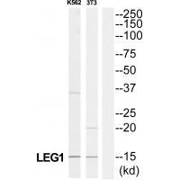 Rabbit Polyclonal Antibody to LAMC3