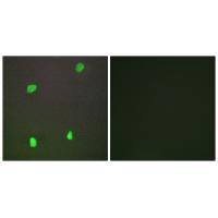 Rabbit Polyclonal Antibody to XRCC3