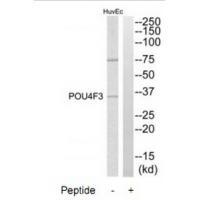 Rabbit Polyclonal Antibody to POU4F3