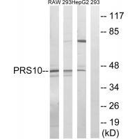 Rabbit Polyclonal Antibody to PSMC6