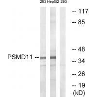 Rabbit Polyclonal Antibody to PSMD11