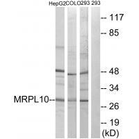 Rabbit Polyclonal Antibody to MRPL1