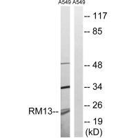 Rabbit Polyclonal Antibody to MRPL13