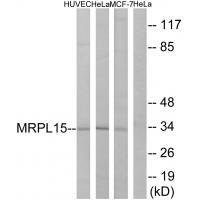 Rabbit Polyclonal Antibody to MRPL15