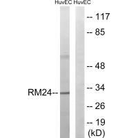 Rabbit Polyclonal Antibody to MRPL24