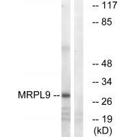 Rabbit Polyclonal Antibody to MRPL9