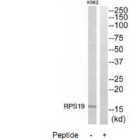 Rabbit Polyclonal Antibody to RPS19