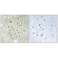 Rabbit Polyclonal Antibody to RPS19BP1