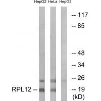 Rabbit Polyclonal Antibody to RPL12