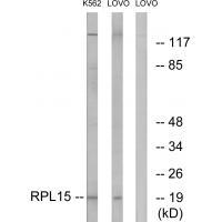 Rabbit Polyclonal Antibody to RPL15