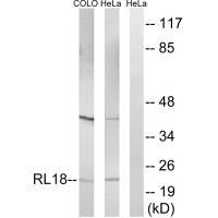 Rabbit Polyclonal Antibody to RPL18