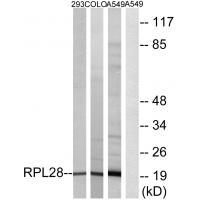 Rabbit Polyclonal Antibody to RPL28