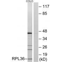 Rabbit Polyclonal Antibody to RPL36