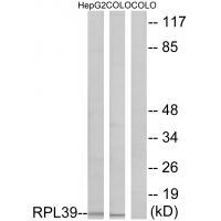Rabbit Polyclonal Antibody to RPL39