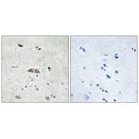 Rabbit Polyclonal Antibody to RL39L