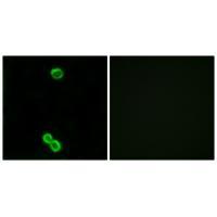 Rabbit Polyclonal Antibody to RPL3L