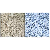 Rabbit Polyclonal Antibody to RPL4