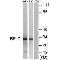 Rabbit Polyclonal Antibody to RPL5