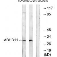 Rabbit Polyclonal Antibody to ABHD11