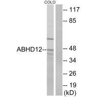 Rabbit Polyclonal Antibody to ABHD12