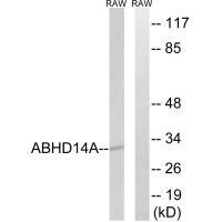 Rabbit Polyclonal Antibody to ABHD14A