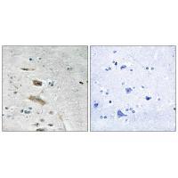 Rabbit Polyclonal Antibody to ABHD4