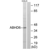 Rabbit Polyclonal Antibody to ABHD6