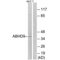 Rabbit Polyclonal Antibody to ABHD9