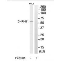 Rabbit Polyclonal Antibody to CHRNB1