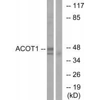 Rabbit Polyclonal Antibody to ACOT1