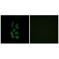 Rabbit Polyclonal Antibody to ACOT12