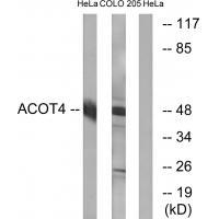 Rabbit Polyclonal Antibody to ACOT4