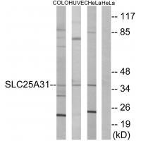 Rabbit Polyclonal Antibody to SLC25A31